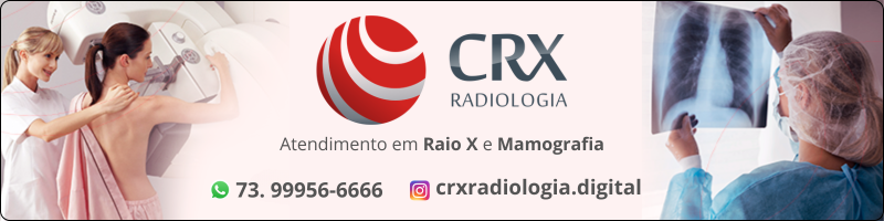 CRX Radiologia 